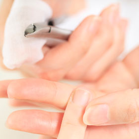 爪カビを予防するにはどうしたらいいの？